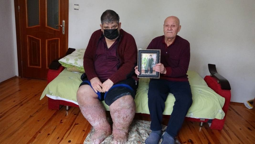 Sivrisinek, hayatının kabusu oldu! Öyle bir hastalığa yakalandı ki doktorlar çaresiz kaldı 9